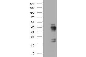 Image no. 1 for anti-Antigen Identified By Monoclonal Antibody Ki-67 (MKI67) (AA 1160-1493) antibody (ABIN1490860) (Ki-67 antibody  (AA 1160-1493))