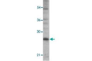 Western blot analysis of PC-3 cells with TICAM2 polyclonal antibody  at 1 ug/mL dilution. (TICAM2 antibody  (C-Term))