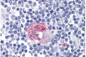 Human Thymus: Formalin-Fixed, Paraffin-Embedded (FFPE) (FCER2 antibody)