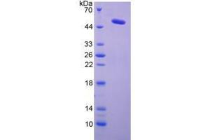 Image no. 1 for Lysyl Oxidase (LOX) (AA 213-417) (Active) protein (His tag,GST tag) (ABIN6239913) (LOX Protein (AA 213-417) (His tag,GST tag))