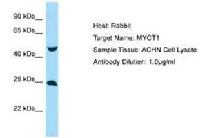 Image no. 1 for anti-Myc Target 1 (MYCT1) (AA 95-144) antibody (ABIN6750014) (Myc Target 1 antibody  (AA 95-144))