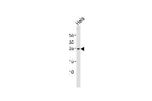 ZNRF2 antibody  (N-Term)