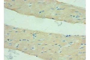 Immunohistochemistry of paraffin-embedded human skeletal muscle tissue using ABIN7144120 at dilution of 1:100 (ANGPTL4 antibody  (AA 26-406))