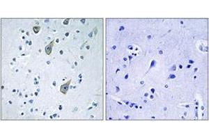 Immunohistochemistry analysis of paraffin-embedded human brain tissue, using FZD6 Antibody. (FZD6 antibody  (AA 116-165))