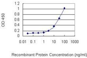 Detection limit for recombinant GST tagged FBXO28 is 0. (FBXO28 antibody  (AA 191-290))