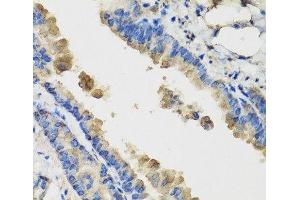 Immunohistochemistry of paraffin-embedded Mouse lung using IL36G Polyclonal Antibody at dilution of 1:100 (40x lens). (IL1F9 antibody)