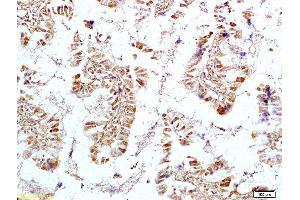 Formalin-fixed and paraffin embedded rat intestine tissue labeled with Anti OTC Polyclonal Antibody, Unconjugated (ABIN720505) at 1:200 followed by conjugation to the secondary antibody and DAB staining (OTC antibody  (AA 51-150))