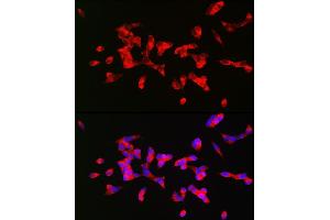 Immunofluorescence analysis of SH-SY5Y cells using CHRM1 Rabbit pAb (ABIN3022210, ABIN3022211, ABIN3022212, ABIN1512760 and ABIN6218670) at dilution of 1:200 (40x lens). (CHRM1 antibody  (C-Term))