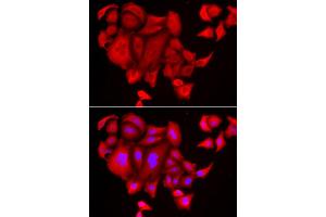 Immunofluorescence analysis of HeLa cell using SLC26A2 antibody. (SLC26A2 antibody)