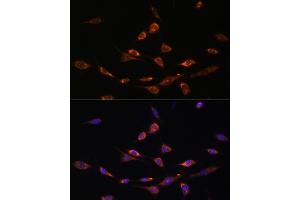Immunofluorescence analysis of NIH-3T3 cells using P antibody (ABIN7269162) at dilution of 1:100. (PAK3 antibody  (AA 1-100))