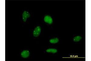 Immunofluorescence of purified MaxPab antibody to E4F1 on HeLa cell. (E4F1 antibody  (AA 1-784))