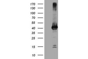 Image no. 1 for anti-Crystallin, Zeta, Homolog antibody (ABIN1497655)