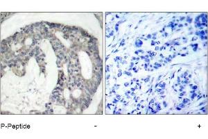 Image no. 1 for anti-Nitric Oxide Synthase 3 (Endothelial Cell) (NOS3) (pSer1177) antibody (ABIN319231) (ENOS antibody  (pSer1177))