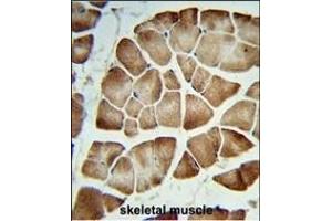 Formalin-fixed and paraffin-embedded human skeletal muscle reacted with COQ3 Antibody (Center), which was peroxidase-conjugated to the secondary antibody, followed by DAB staining. (COQ3 antibody  (AA 172-201))