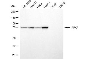 Western blotting analysis using PFKP antibody (ABIN7799802).
