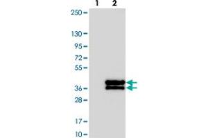Western blot analysis of Lane 1: Negative control (vector only transfected HEK293T lysate). (KIF25 antibody)