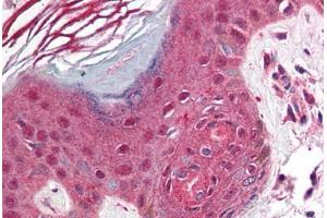 Human Skin (formalin-fixed, paraffin-embedded) stained with PDCD1 antibody ABIN214464 at 2. (PD-1 antibody  (C-Term))