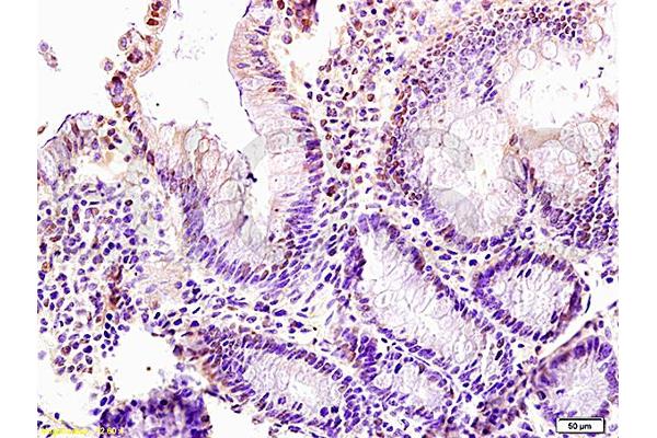 LZTFL1 antibody  (AA 101-200)