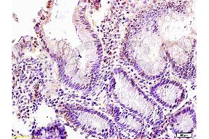 Formalin-fixed and paraffin: rat intestine tissue labeled with Anti-LZTFL1 Polyclonal Antibody (ABIN755407), Unconjugated at at 1:200 followed by conjugation to the secondary antibody and DAB staining (LZTFL1 antibody  (AA 101-200))