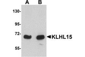 Western Blotting (WB) image for anti-Kelch-Like 15 (KLHL15) (C-Term) antibody (ABIN1030470) (KLHL15 antibody  (C-Term))