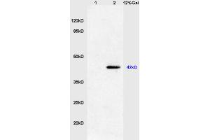 Lane 1: mouse heart lysates Lane 2: mouse S/P20 cell lysates probed with Anti phospho-ERK1(Thr202/Tyr204) +ERK2(Thr183/Tyr185) Polyclonal Antibody, Unconjugated (ABIN732458) at 1:200 in 4 °C. (ERK1/2 antibody  (pThr183, pTyr185))