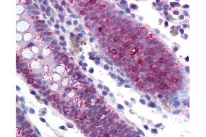 Anti-SF1 antibody IHC of human colon. (Splicing Factor 1 antibody  (AA 517-566))