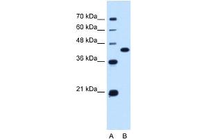 WB Suggested Anti-SLC14A1 Antibody Titration:  0. (SLC14A1 antibody  (C-Term))