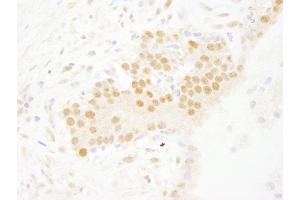 anti-SET Domain Containing 8 Pseudogene 1 (SETD8P1) (AA 316-366) antibody