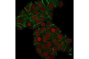 Confocal Immunofluorescence of MCF-7 cells E-Cadherin Mouse Monoclonal Antibody (CDH1/1525). (E-cadherin antibody)