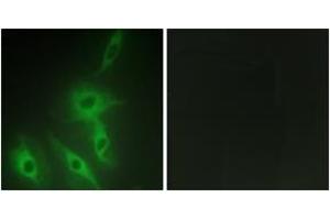 Immunofluorescence analysis of HeLa cells, using AS250 Antibody. (RALGAPA2 antibody  (AA 641-690))