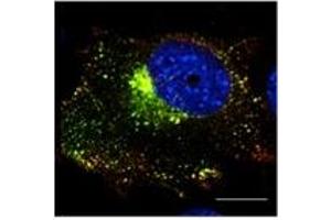 Immunofluorecence — anti-Rab5a Ab in transduted Hepa1-6 cells with Ad GFP-Rab5a at 1/50 dilution; cells were fixed with 4% of PFA;