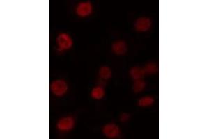 ABIN6274221 staining 293 cells by IF/ICC. (MZF1 antibody  (N-Term))