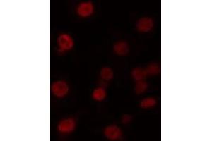 ABIN6274221 staining 293 cells by IF/ICC.