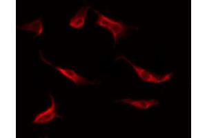 ABIN6269245 staining Hela by IF/ICC. (STAT1 antibody)