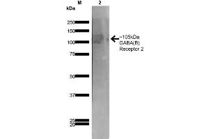 Western Blot analysis of Rat Brain Membrane showing detection of ~105 kDa GABA B Receptor 2 protein using Mouse Anti-GABA B Receptor 2 Monoclonal Antibody, Clone S81-2 . (GABBR2 antibody  (AA 861-912))