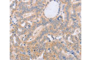 Immunohistochemistry (IHC) image for anti-Bone Marrow Stromal Cell Antigen 1 (BST1) antibody (ABIN2432739)