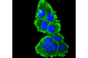 HeLa cells were fixed in paraformaldehyde, permeabilized with 0. (KRT16 antibody)