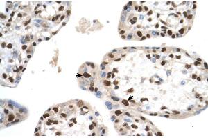 SETD2 antibody - N-terminal region  validated by IHC using Human Placenta lysate at 4. (SETD2 antibody  (N-Term))