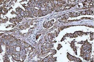 IHC analysis of DTR/HBEGF using anti-DTR/HBEGF antibody (ABIN7603042). (HBEGF antibody  (Middle Region))