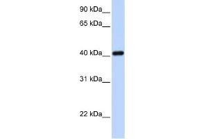 WB Suggested Anti-IRX6 Antibody Titration:  0.