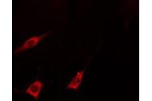 ABIN6275378 staining  293 cells by IF/ICC. (KCNA5 antibody  (Internal Region))