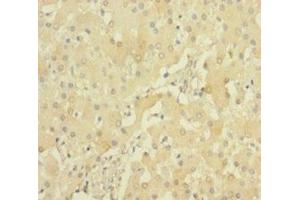 Immunohistochemistry of paraffin-embedded human liver tissue using ABIN7168904 at dilution of 1:100 (PRSS23 antibody  (AA 20-383))