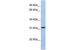 WB Suggested Anti-SLC25A28 Antibody Titration:  1 ug/ml  Positive Control:  MCF-7 whole cell lysates (SLC25A28 antibody  (C-Term))