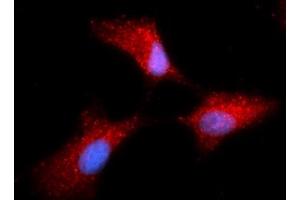 Immunofluorescence (IF) image for anti-Complexin 1 (CPLX1) (AA 1-134) antibody (APC) (ABIN5565317)