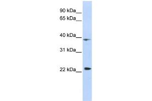 WB Suggested Anti-PRR11 Antibody Titration:  0. (PRR11 antibody  (Middle Region))