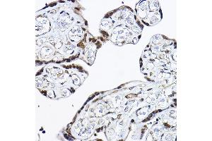 Immunohistochemistry of paraffin-embedded human placenta using [KO Validated] PDCD4 Rabbit pAb (ABIN3023387, ABIN3023388, ABIN3023389 and ABIN1681284) at dilution of 1:25 (40x lens). (PDCD4 antibody  (AA 1-260))
