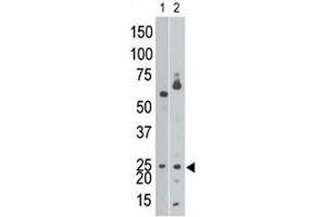 The BNIP3 antibody western blot analysis of Ramos cell lysate (lane 1) and in mouse brain tissue lysate (2). (BNIP3 antibody  (AA 152-187))