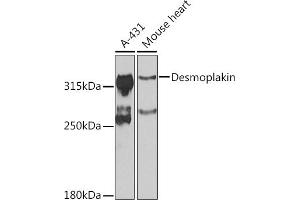Western blot analysis of extracts of various cell lines, using Desmoplakin antibody (ABIN6134106, ABIN6139838, ABIN6139840 and ABIN6223548) at 1:1000 dilution. (Desmoplakin antibody  (AA 1-100))