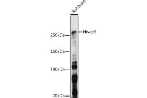 Western blot analysis of extracts of Rat brain, using Hivep3 antibody (ABIN7267792) at 1:1000 dilution. (Human Immunodeficiency Virus Type I Enhancer Binding Protein 3 (HIVEP3) antibody)
