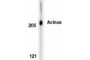 Western blot analysis of Acinus in K562 whole cell lysate with AP30011PU-N Acinus antibody at 0. (ACIN1 antibody  (C-Term))